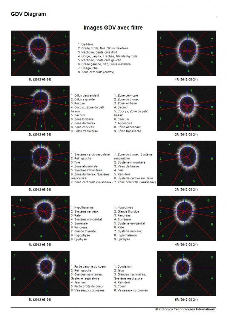émission des photons captés sur les doigts